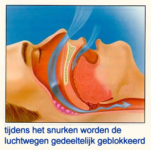 snurken-keelholte-grafisch